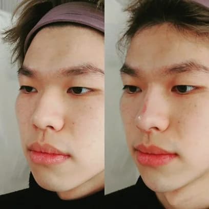 Facial Refinement