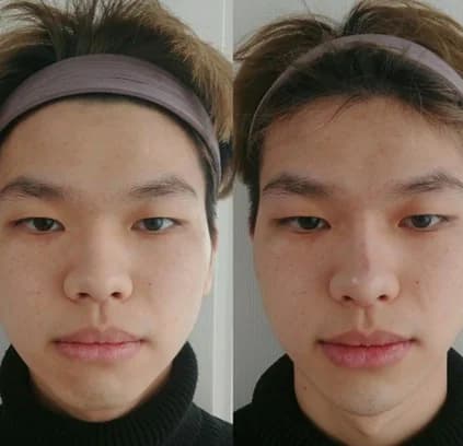 Facial Contour