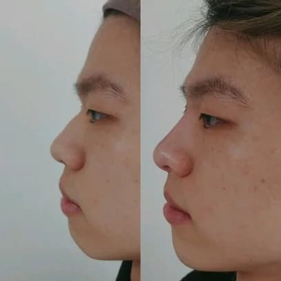Profile Refinement
